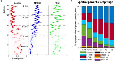 Basal Ganglia Local Field Potentials as a Potential Biomarker for Sleep Disturbance in Parkinson's Disease